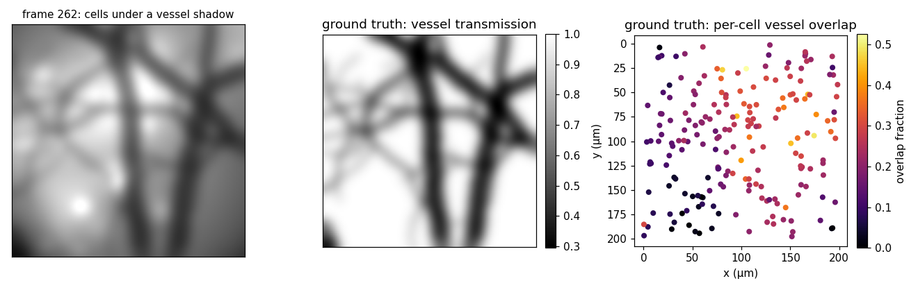 a frame with a vessel shadow, the vessel transmission mask, and per-cell vessel overlap